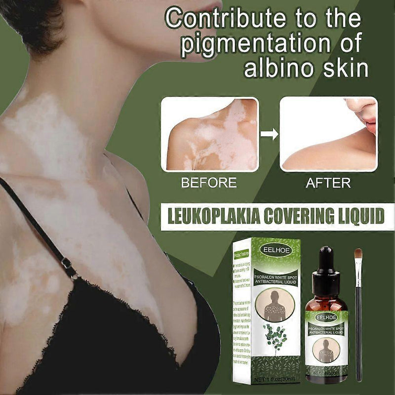 EELHOE Vitiligo Psoralcn White Spot Remove Serum ( BUY 1 GET 1 FREE)