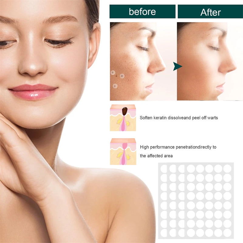 20PCS/Box Warts Remover Patch Safe Painless Skin Tags Patches Wart Treatment Patch Fast Acting Remover Warts Moles