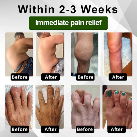 Emu Oil JointRelief Ointment (BUY 1 GET 1 FREE)