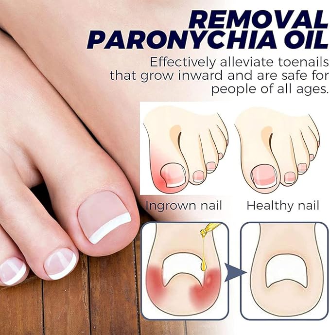 Removal Paronychia Oil ( BUY 1 GET 1 FREE )