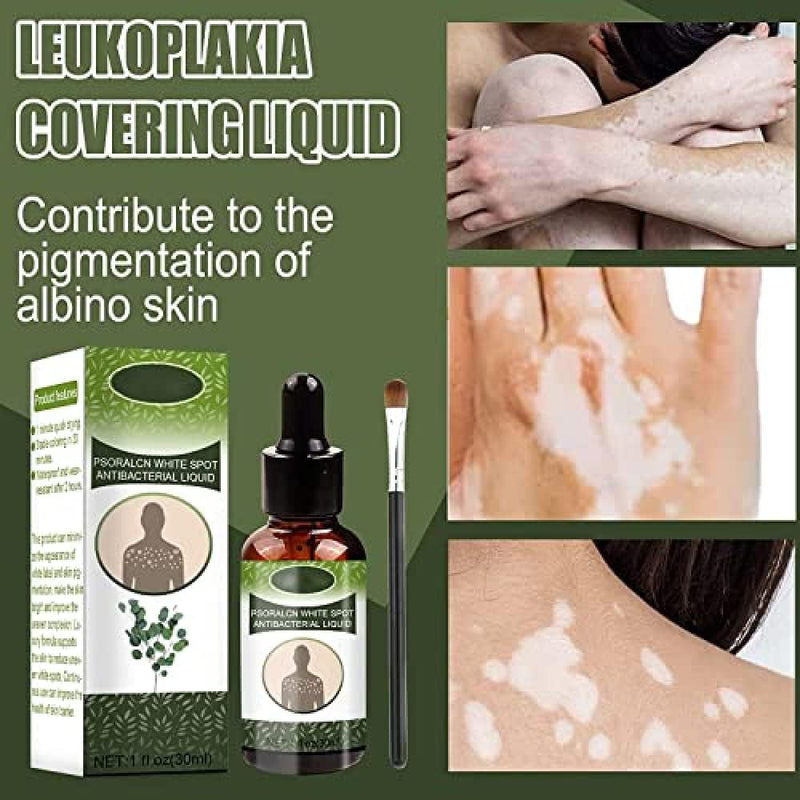EELHOE Vitiligo Psoralcn White Spot Remove Serum ( BUY 1 GET 1 FREE)