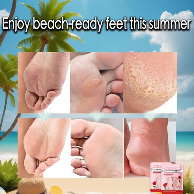 Sandoer Moisturizing Foot & Hand Mask  (BUY 1 GET 1 FREE)