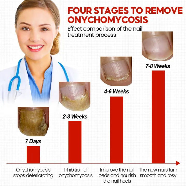 Removal Paronychia Oil ( BUY 1 GET 1 FREE )