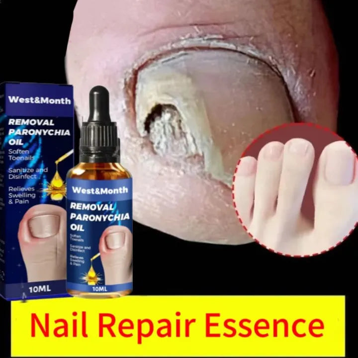 Removal Paronychia Oil ( BUY 1 GET 1 FREE )