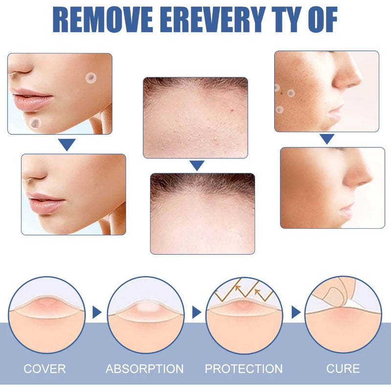 EELHOE Skin Tag Patch Mole and Wart Remover Herbal Extract Invisible Warts Stickers 144pcs