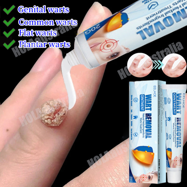 Wart Remover Ointment - Effective Cream( BUY 1 GET 1 FREE )
