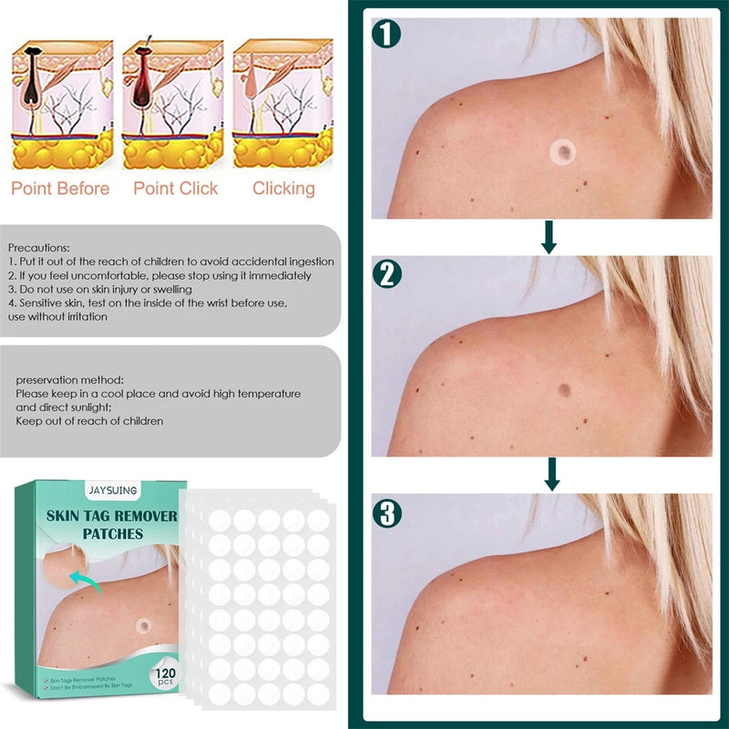 20PCS/Box Warts Remover Patch Safe Painless Skin Tags Patches Wart Treatment Patch Fast Acting Remover Warts Moles