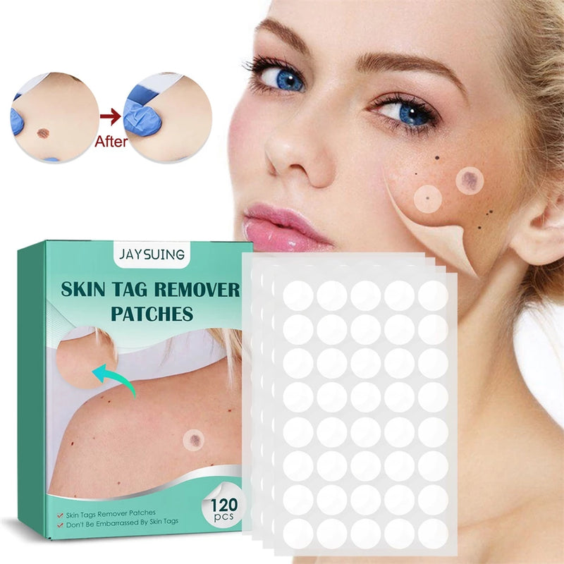 20PCS/Box Warts Remover Patch Safe Painless Skin Tags Patches Wart Treatment Patch Fast Acting Remover Warts Moles