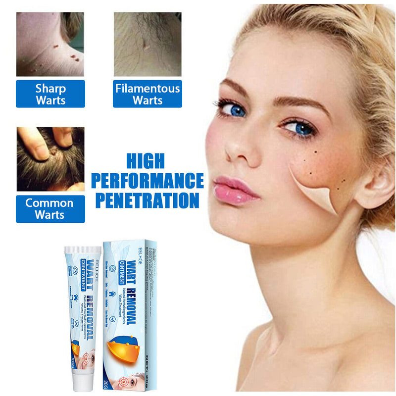 Wart Remover Ointment - Effective Cream( BUY 1 GET 1 FREE )