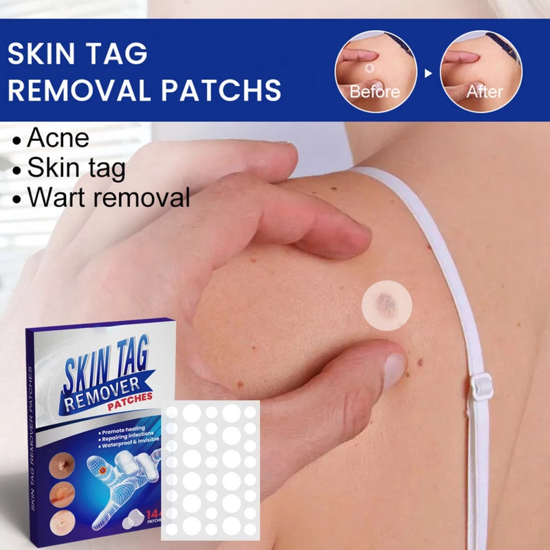 144PCS/Box Skin Tag Remove Patches Wart Remover Patch Waterproof Skin Care Stickers Skin-Friendly Painless