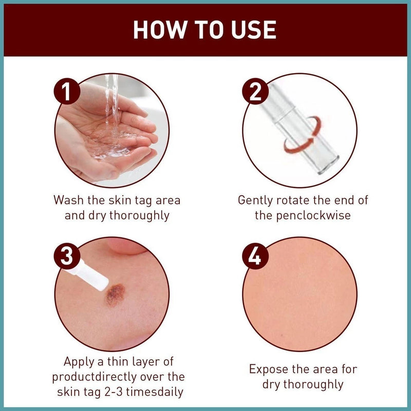 LOVILDS™ Tags & Moles Remover (Buy 1 Get 1 Free🔥🔥)