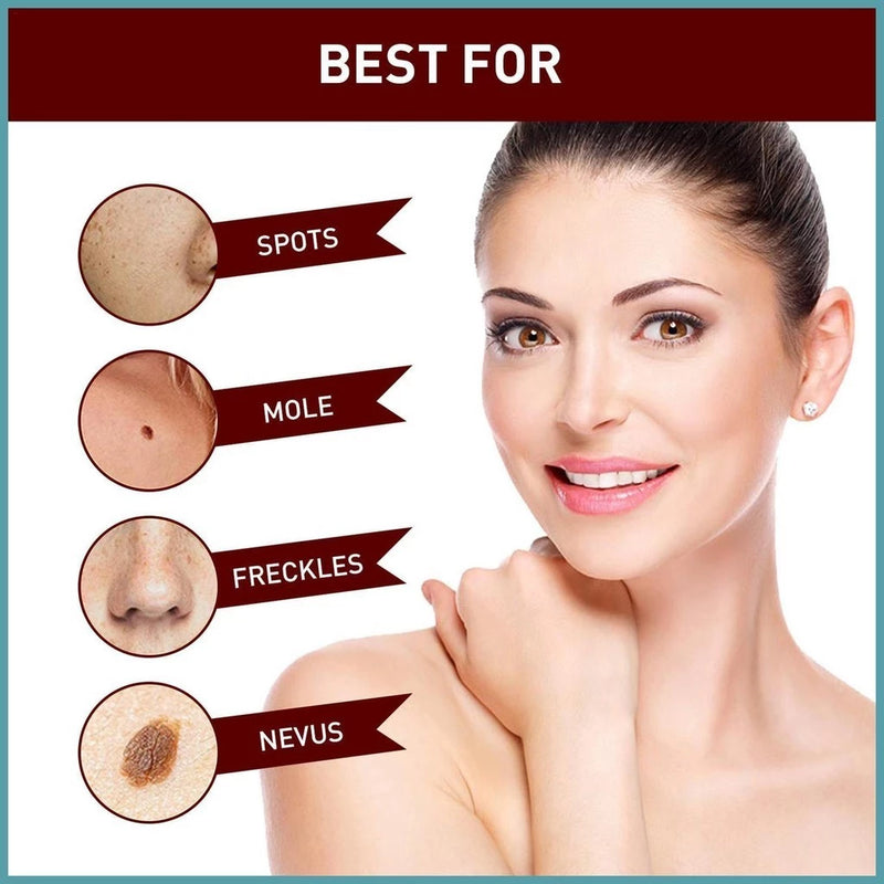 LOVILDS™ Tags & Moles Remover (Buy 1 Get 1 Free🔥🔥)