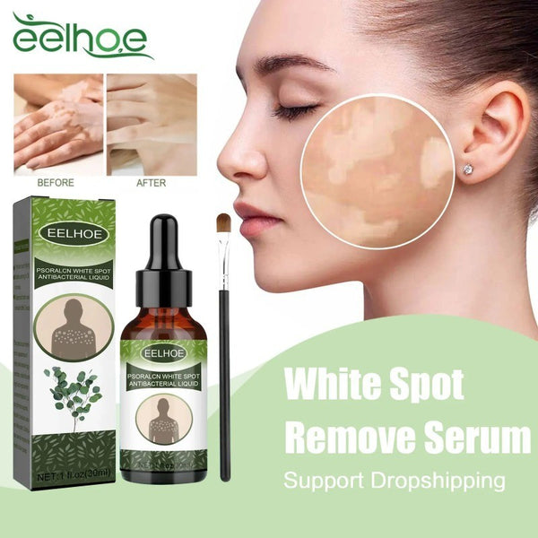 EELHOE Vitiligo Psoralcn White Spot Remove Serum ( BUY 1 GET 1 FREE)
