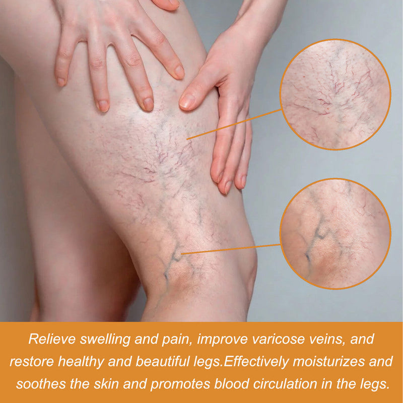 Turmeric Varicose Vein Relief Spray( BUY 1 GET 2 FREE💥 🎁  )