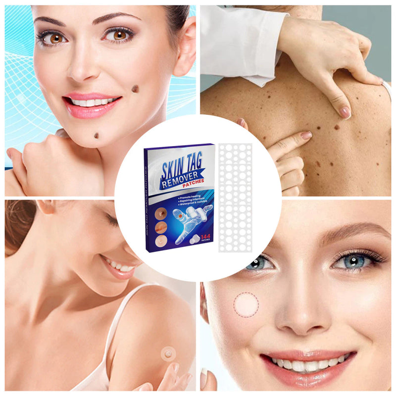 144PCS/Box Skin Tag Remove Patches Wart Remover Patch Waterproof Skin Care Stickers Skin-Friendly Painless