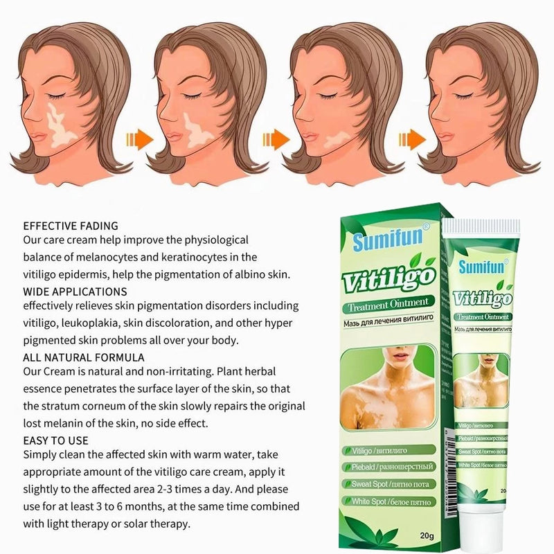 Sumifun Vitiligo Treatment Cream (BUY 1 GET 1 FREE)